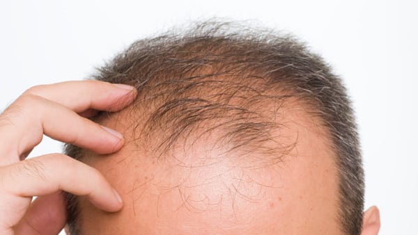 Hair follicle disorders - RightDiagnosis.com