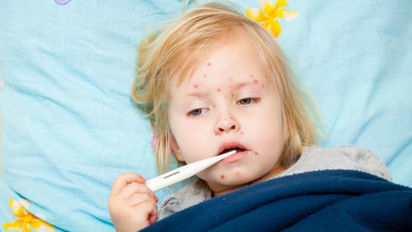 Viral illnesses in Children